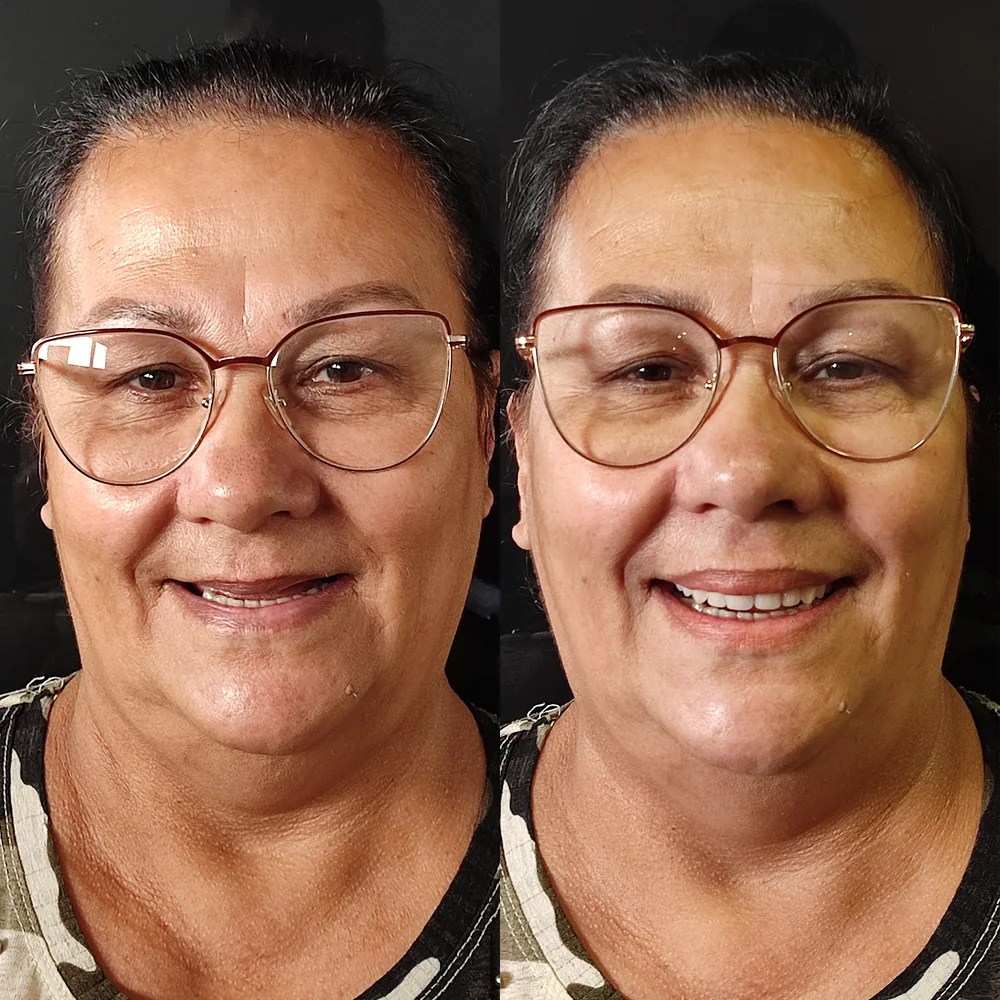 Paciente da Ennova com o sorriso reabilitado na clínica de Curitiba